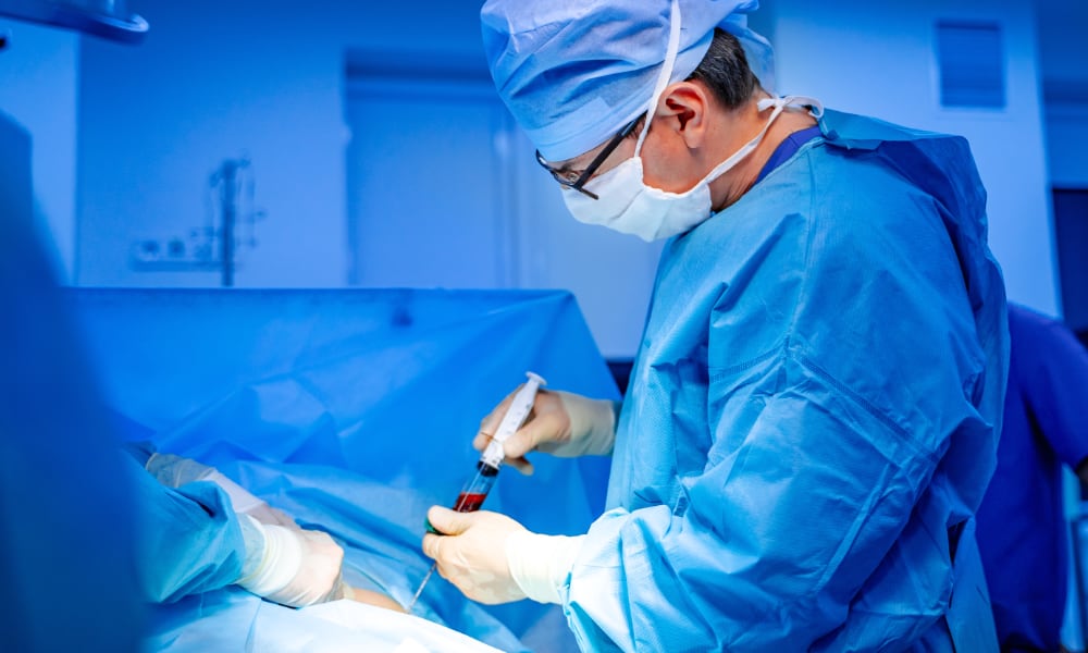 PRP (Platelet Rich Plasma) Tedavisi