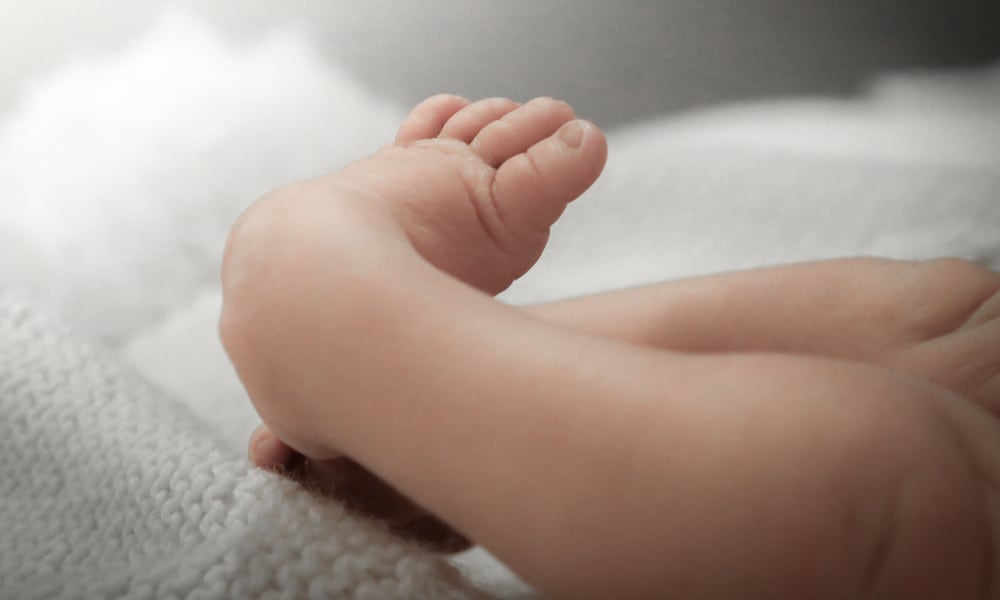 Doğuştan Çarpık Ayak