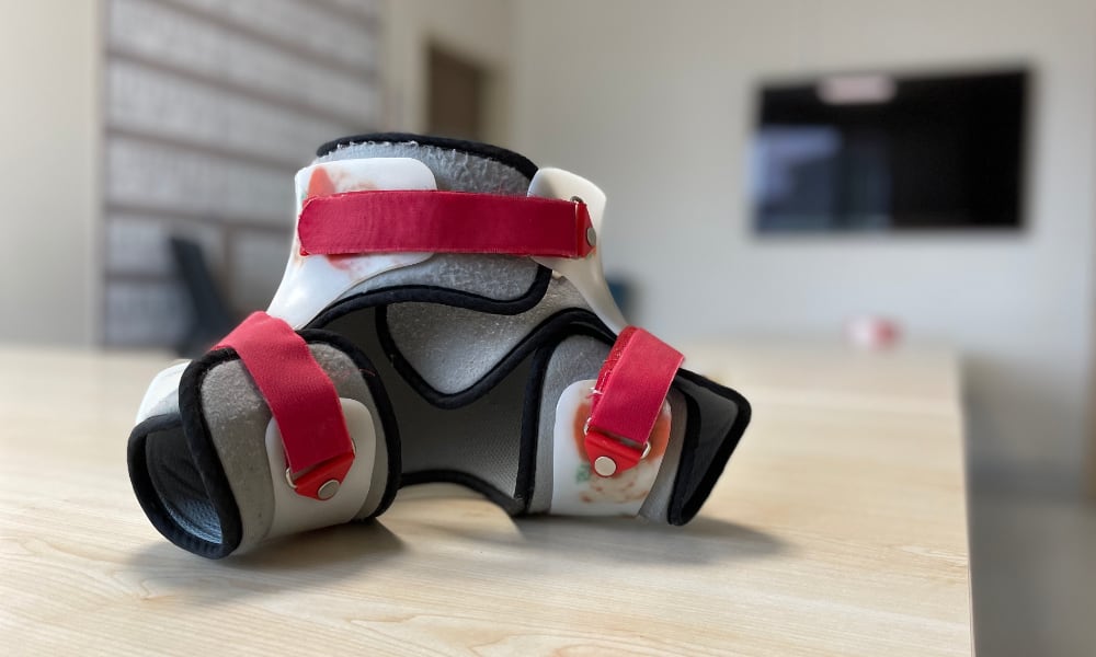 Gelişimsel Kalça Displazisi