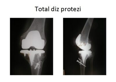 Yediden 77’e Diz Hastalıkları